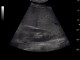 29-ecoabdominal