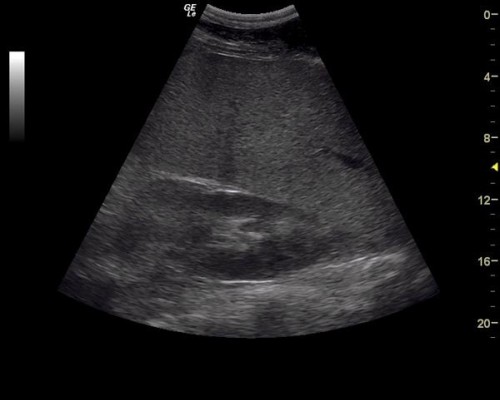 29-ecoabdominal
