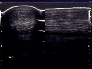 03-2semanas-ondas-choque