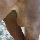 BURSITIS